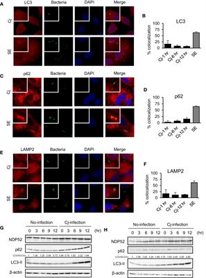 Recruitment of LC3 by Campylobacter jejuni to Bacterial Invasion Site on Host Cells via the Rac1-Mediated Signaling Pathway